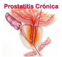 prostatitis bacteriana en perros)