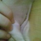 mi barriguita recien operada =(
pero ya eso es pasado comunidad
ahora estoy muuuy bien =)
y ya casi no hay cicatriz =)